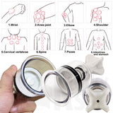 Traditional Chinese Style Suction Cupping Cups